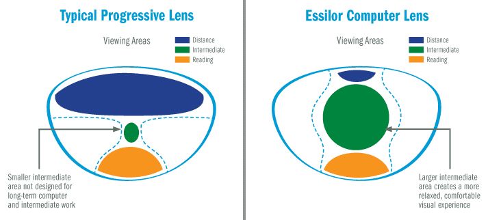 Progression vs essilor lenses